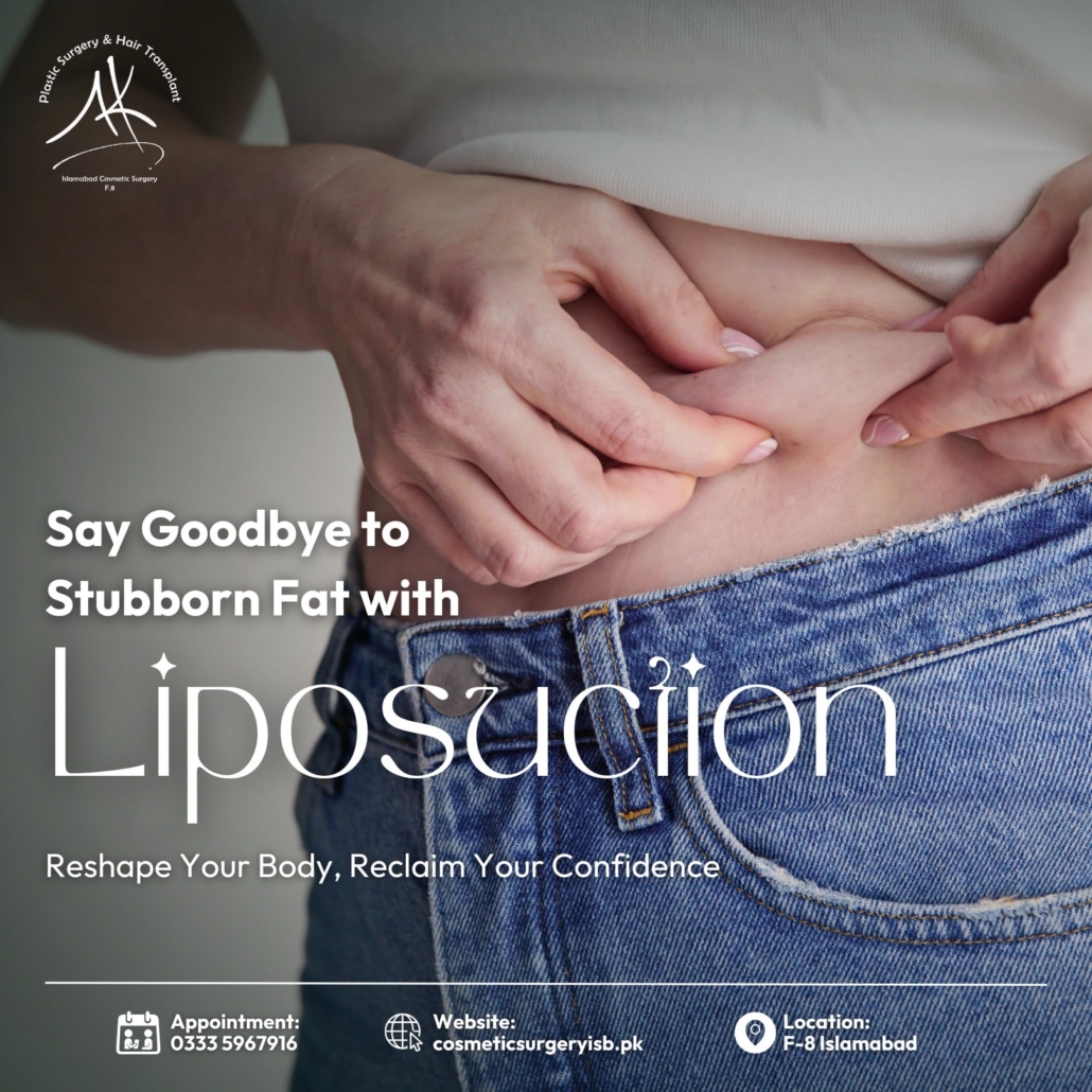 Dr. Abdul Khaliq performing liposuction in Islamabad