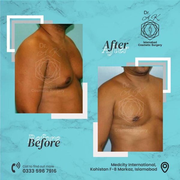 Dr. Abdul Khaliq with his cosmetic surgery team