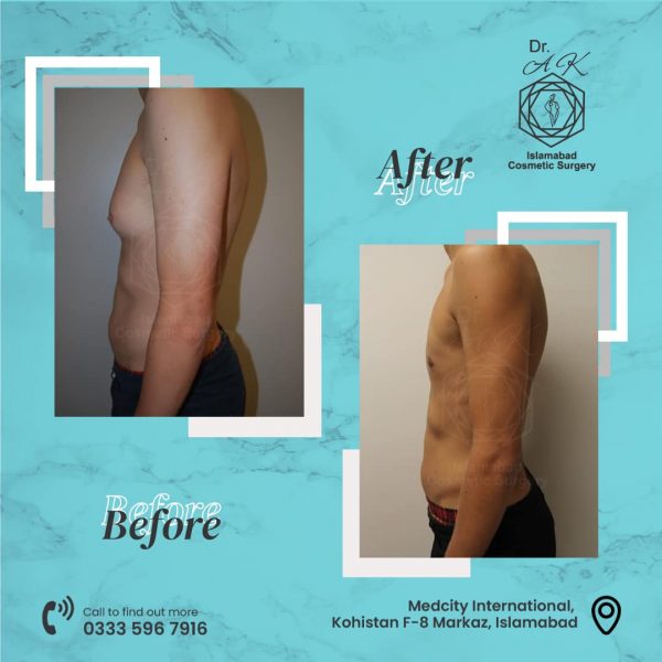 Plastic surgeon with years of experience in body contouring
